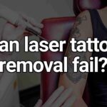 Can laser tattoo removal fail?